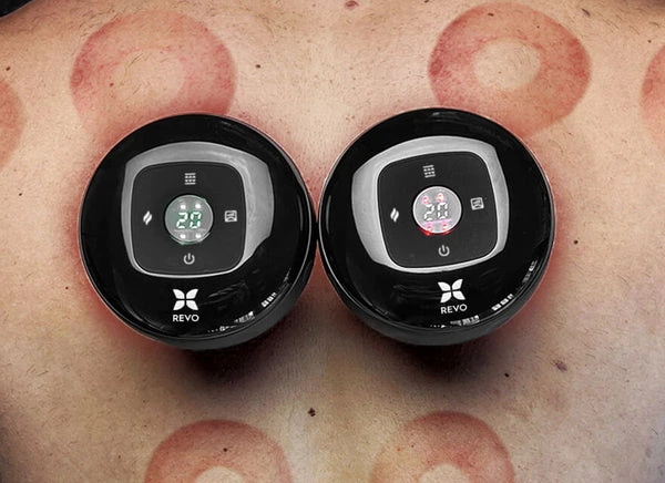 revomadic cupper Soothe Your Back